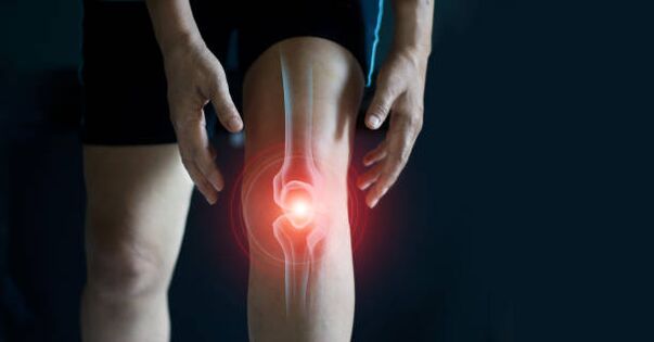 Arthrose des Kniegelenks